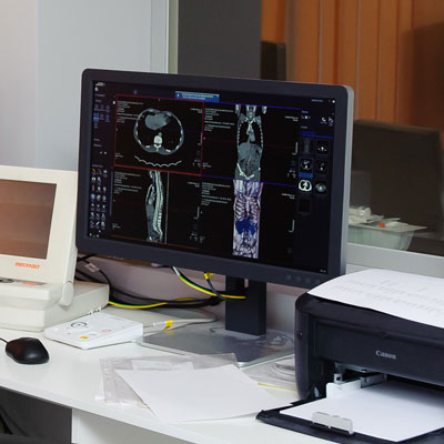 Магнітно-резонансна томографія (МРТ) грудного відділу хребта